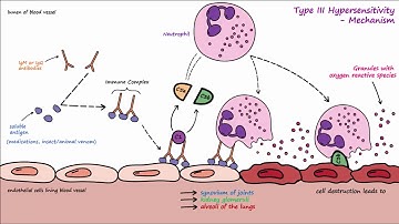 Type III Hypersensitivity
