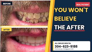 The Truth About Modern Dentures — Dr. Roger Suter on 304 Today