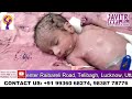 5 साल बाद दम्पति का इंतजार हुआ ख़त्म | Best IVF Doctor in Lucknow
