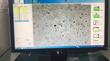 Live video of FA160 Feces Analyzer in hospital by Fully automatic feces analyzer of Orienter