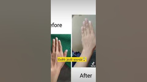 Thumbnail of review collagen drink / eld collagen / eld collagen drink || phmshop16