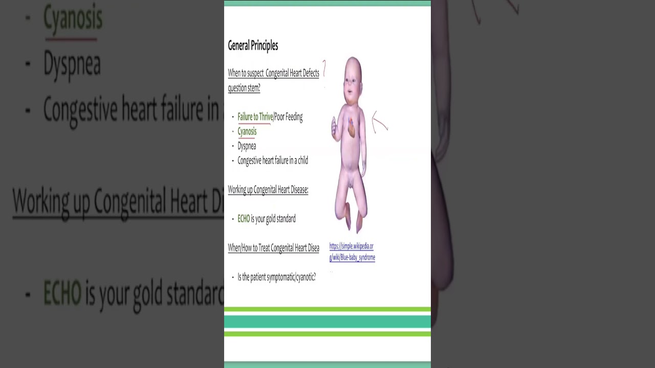 Congenital heart disease