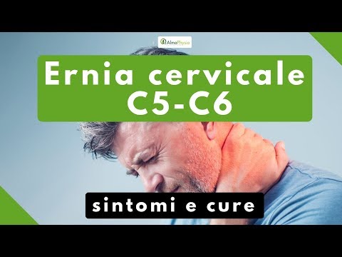 ernia cervicale C5 C6 sintomi e cure