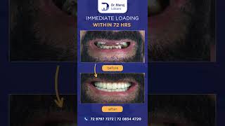 Immediate Loading Within 72 Hrs 7208344720 Dr Manoj