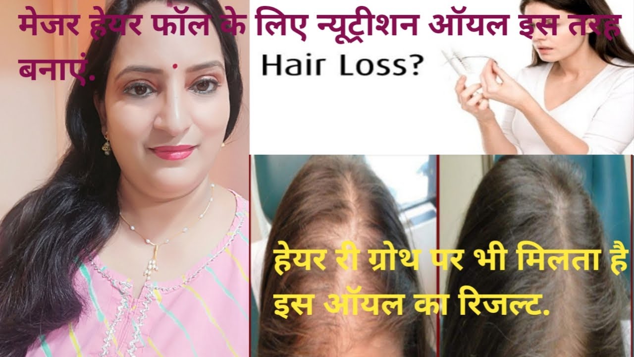 Hair fall ko kaise roke/hair regrowth kaise kare by Kalpana kalpana