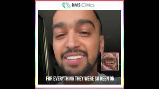 هوليود سمايل - Hollywood Smile - BMS Clinics -Sourire Hollywoodien