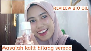 BIO OIL PENGHILANG BEKAS LUKA YANG AMPUH BANGET II MANFAAT DAN REVIEW BIO OIl