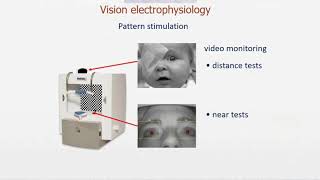 MonPackONE -3- Vision electrophysiology   Pattern ERG and VEP