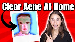 Clear Acne At Home With Phototherapy | Omnilux Clear Net Worth
