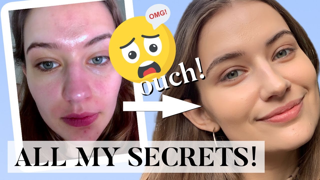 HOW I CLEARED MY SKIN 2020 | MY SKINCARE ROUTINE + SKIN TIPS! - YouTube