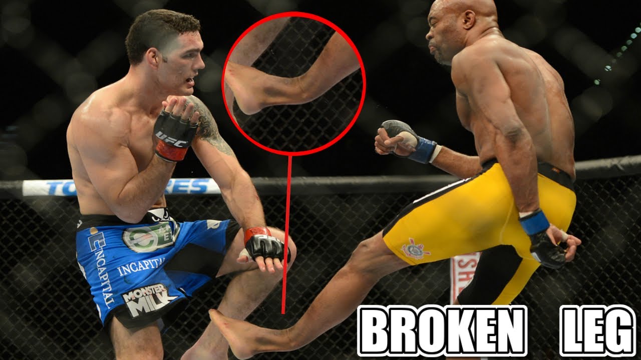 Anderson Silva Horrible Broken Leg Injury At UFC 237 - YouTube