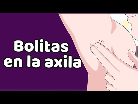 Video: Cómo evitar y tratar las axilas hinchadas