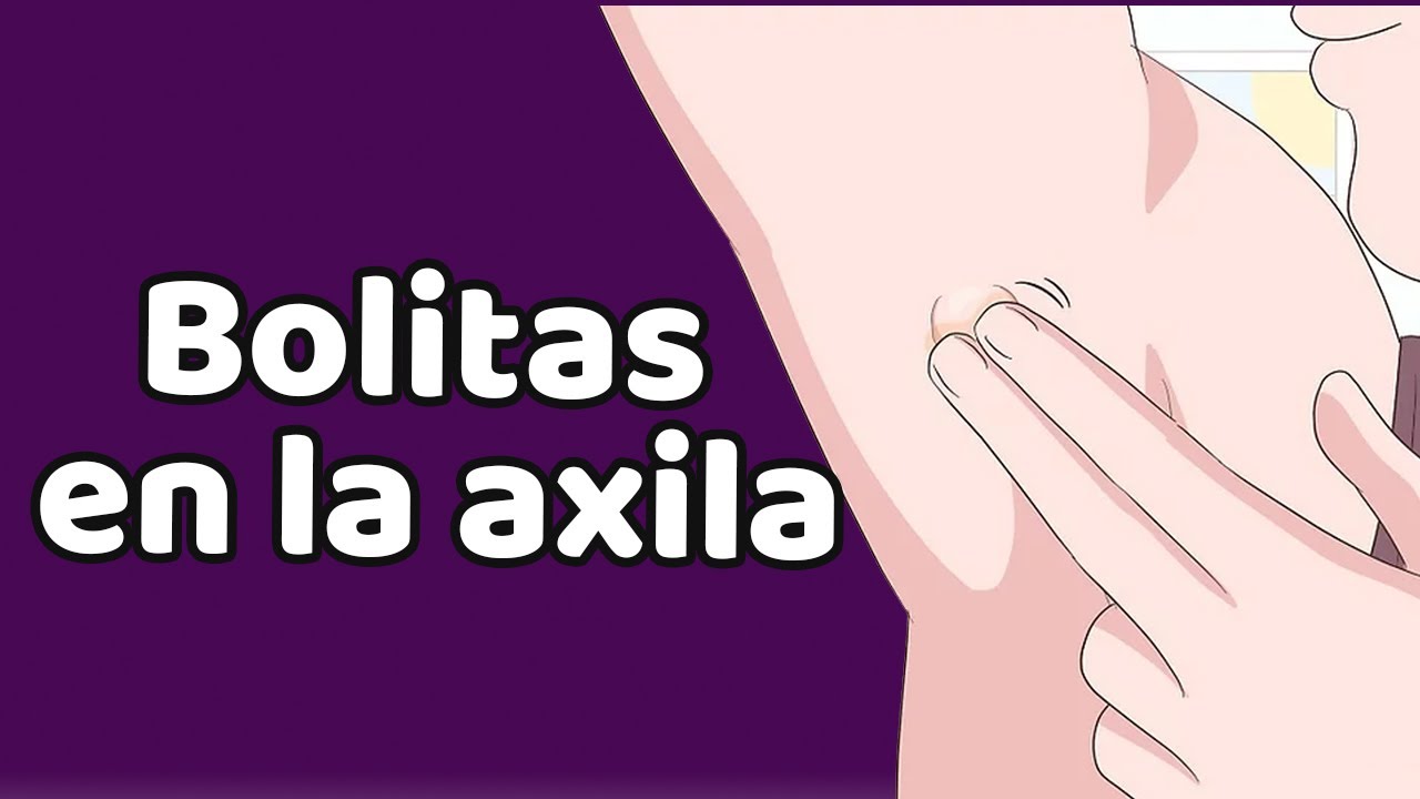 Dolor en la axila izquierda