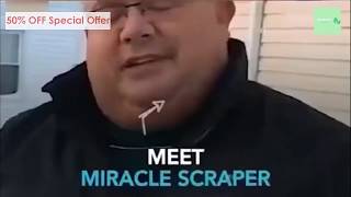 Magic Car Ice Scraper BestCar™