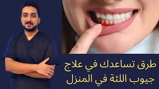 4 طرق قد تساعدك في علاج جيوب اللثة في المنزل