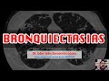 Bronquiectasias ICEST