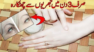 Get Rid of WRINKLES in 7 Day Completely with Anti Wrinkle Cream from Under Eye or Face Urdu Hindi