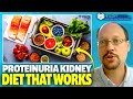 Proteinuria Diet: Diet For Patients With Nephrotic Syndrome, Proteinuria, Nephritis Syndrome, etc.