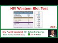 Understanding the HIV Western Blot Test: Accuracy, Results &amp; What it Means for You