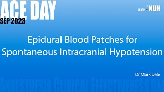 Epidural Blood Patches for Spontaneous Intracranial Hypotension