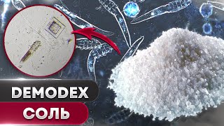 Соль против клеща | Угревая Железница Demodex