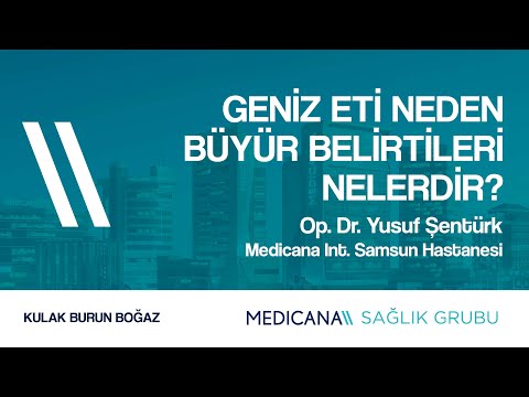Geniz Eti Neden