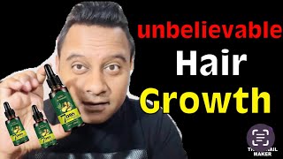 Unlock Unbelievable Hair Growth: 7 Days with Ginger Oil