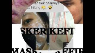 Masker Kefir Batam - 082385531953 (Tsell)