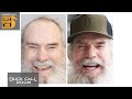 New Smile, New Uncle Si! | Duck Call Room #495