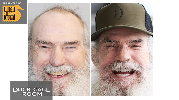 New Smile, New Uncle Si! | Duck Call Room #494
