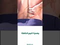 أسباب ألم الظهر الصباحي