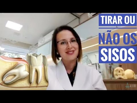 Vídeo: Quais são os dentes do siso?