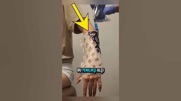 Swimming with a Cast? Yes, It's Possible! 🏊‍♂️🩹💪