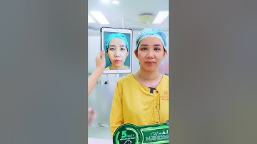 Cắt mí A.I Nano Matrix Deep: Khách hàng thay đổi diện mạo đôi mắt "thần tốc" chỉ với 30 phút!