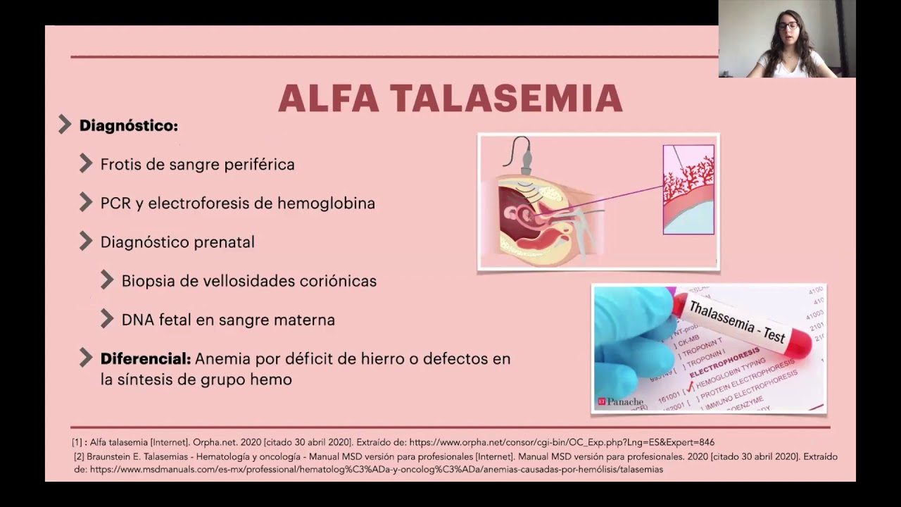 Alfa Talasemia - Sofía Lamuño - YouTube