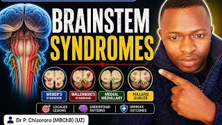 Stroke High-Yield (4/7): Brainstem Syndromes
