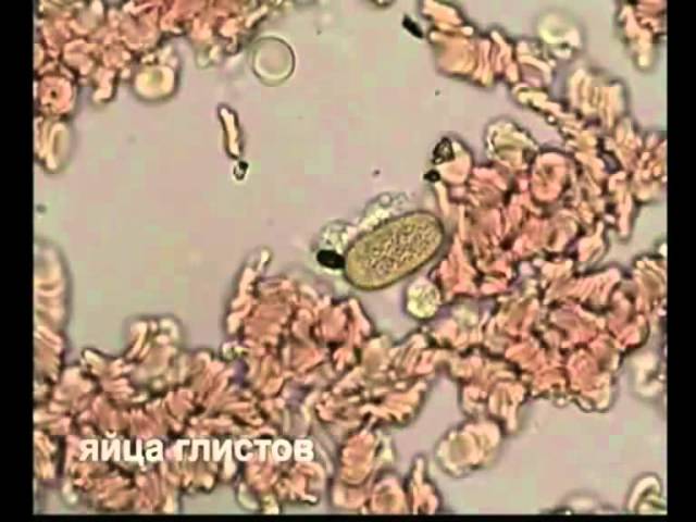 Кровь при увеличении в 1000 раз! Что там можно обнаружить!