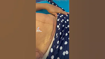 شكل جرح القيصريه و طريقه فك الغرزة 