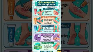 Top 5 Essential Creams & Their Uses | Health Tips #Shorts #Viral #gingerwater #vata #turmericwater