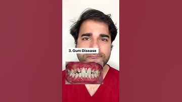 What causes DENTAL SENSITIVITY? #shorts #trending #youtubeshorts #dentist #teeth #health #tips #life