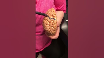 Fissures & Gyrus of Brain