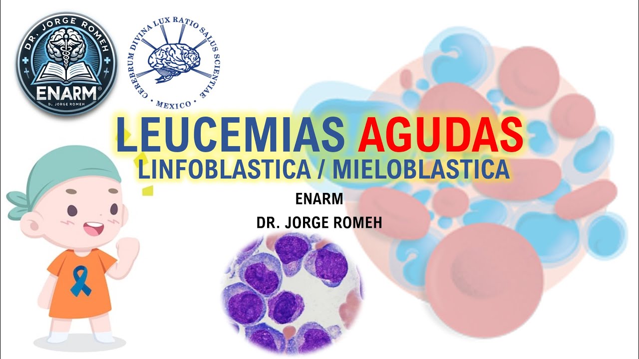 LEUCEMIA AGUDA LINFOBLASTICA Y MIELOBLASTICA (LEUCEMIAS) - ENARM - TODO LO QUE DEBES SABER