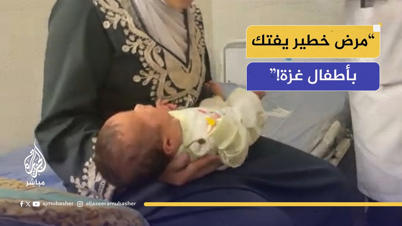 حالة طبية كارثية في غزة.. شاهد الأطفال يعانون أشد الأمراض