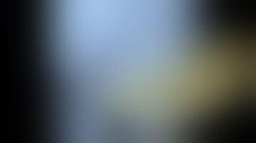 TRANSPAROTID APPROACH TO FRACTURED CONDYLE. | ORAL SURGERY