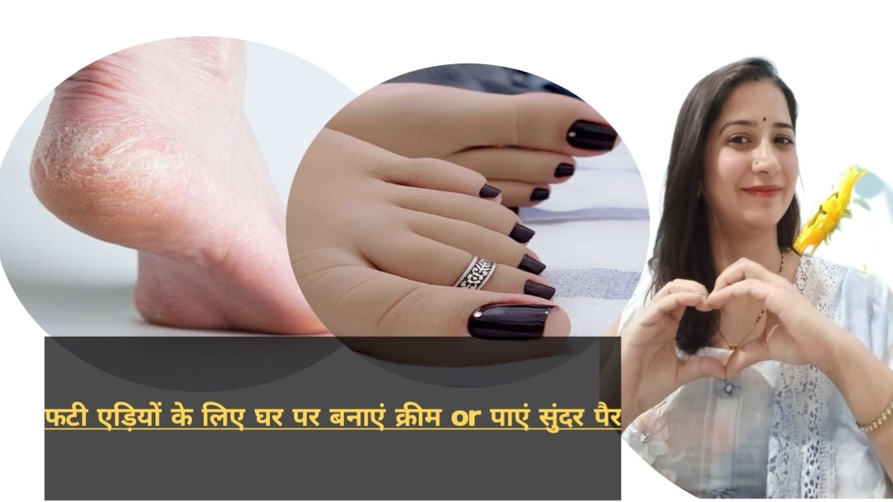 Want soft and smooth heels?Crack heels treatment at home 