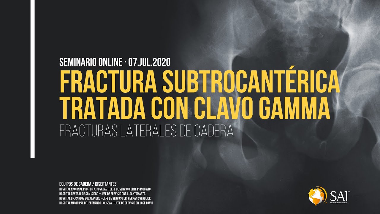 Fractura subtrocantérica tratada con Clavo Gamma | Seminario Online South America Implants