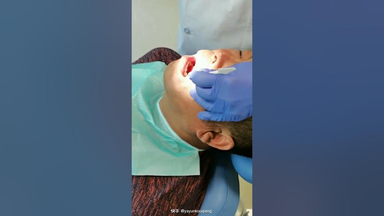 Tooth Filling Cuspid Tooth Extraction Teeth Expander Process
