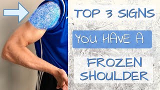 Top 3 Signs You Have A Frozen Shoulder. 3 SelfTests You Can Do (Adhesive Capsulitis)