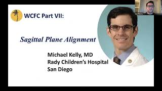 Sagittal Plane Alignment: Michael Kelly, MD - West Coast Fellows