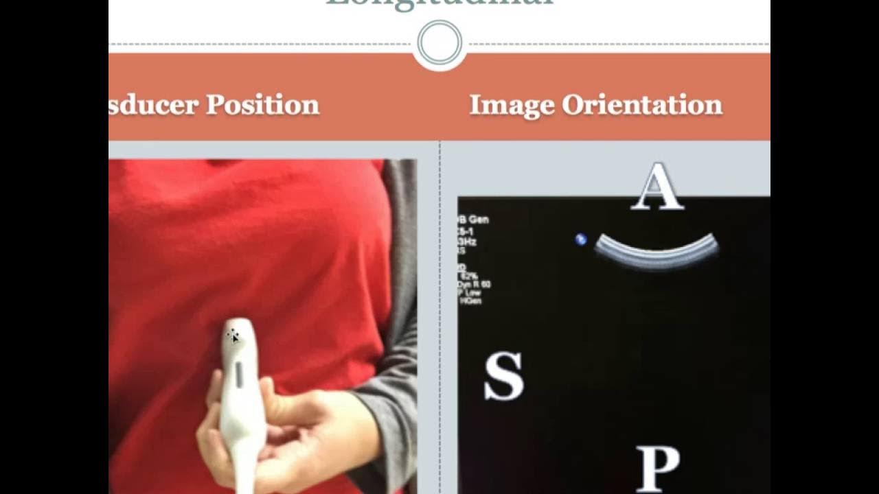 image-orientation-and-transducer-position-youtube